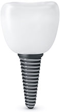 Dental Implants dental-implants